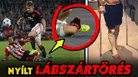 10 legbrutálisabb sérülés a futballtörténelemben