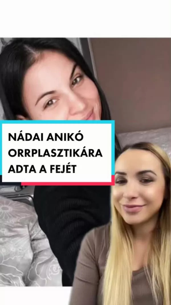 Nádai Anikó bejelentette: plasztikáztat. Na de mit?