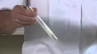Az epe szerepe az emésztésben - Epehiány állhat az emésztési problémák hátterében