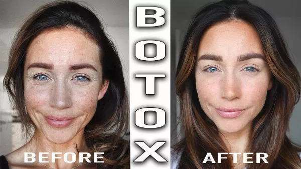 Fröccsenjen a Botox! - Botox partit rendeznek Budapesten