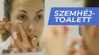 Állandó könnyezés? Irritált szemek? Szemhéj gyulladás lehet a háttérben