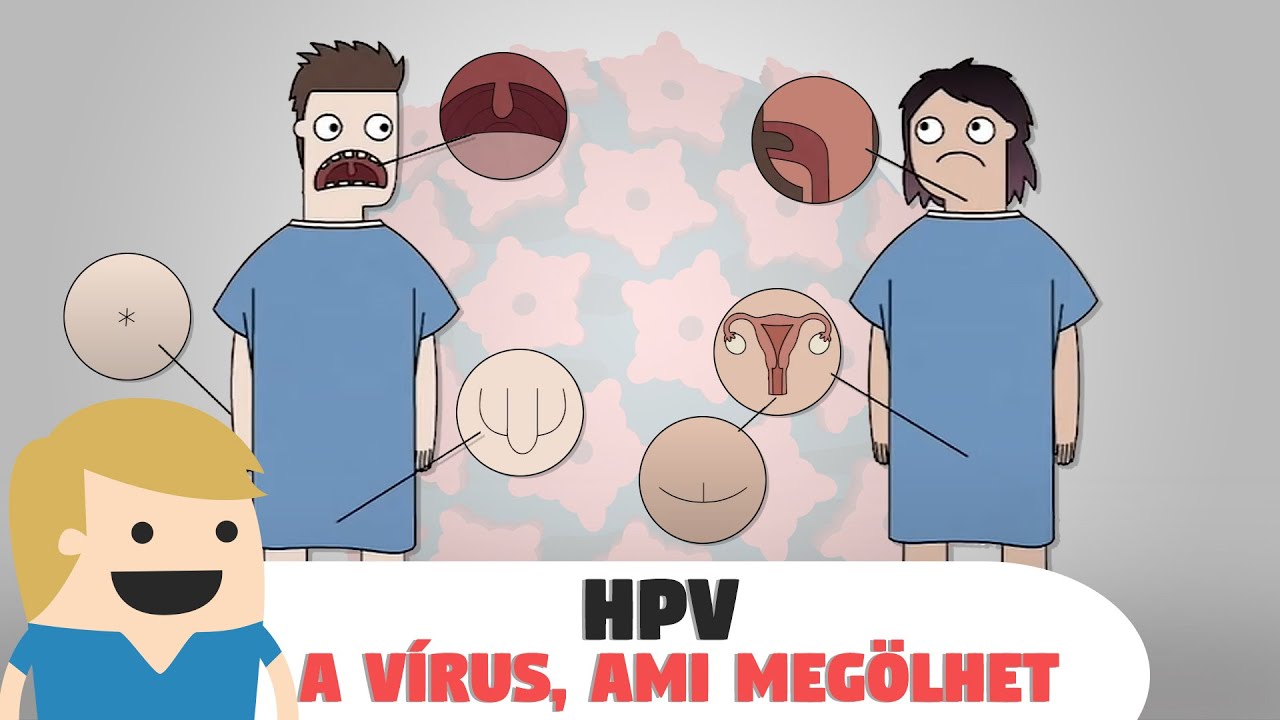 HPV - a vírus ami benned is ott van és végezhet veled!