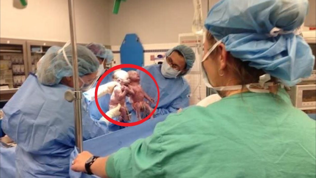 Szülés után másodpercekkel a nőgyógyásznak leesett az álla, amikor ezt meglátta!