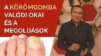 Körömgomba kialakulásának valódi okai. Körömgomba tünetei, körömgomba elleni szerek, kezelése házilag. 