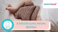 A köldökcsonk helyes ápolása 