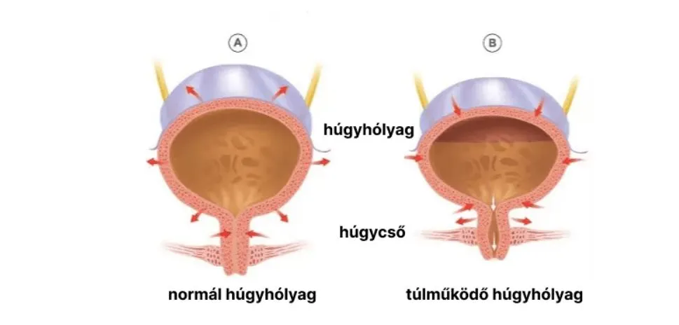 hugyhólyag