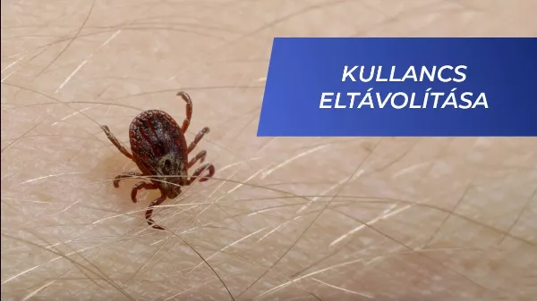 Vigyázz! Így támadnak a kullancsok! Oktatóvideó: Kullancs 🕷 eltávolítása