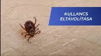 Vigyázz! Így támadnak a kullancsok! Oktatóvideó: Kullancs 🕷 eltávolítása