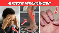 8 Figyelmeztető vészjel a testedből! Ismerd fel az alacsony véroxigénszint alattomos tüneteit