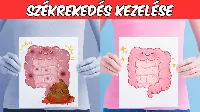 6 egyszerű és természetes gyógymód székrekedés 🚽 ellen, amit nem hittél volna!