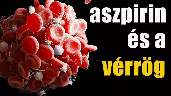 Aszpirin – Mikor segít, és mikor veszélyes igazán?