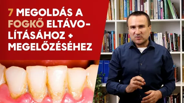 7 Hatékony Megoldás a Fogkő Eltávolítására és Megelőzésére