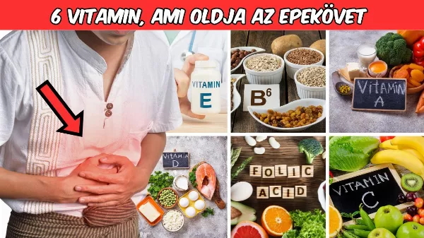 6 Vitamin, ami segít eltávolítani az epekövet