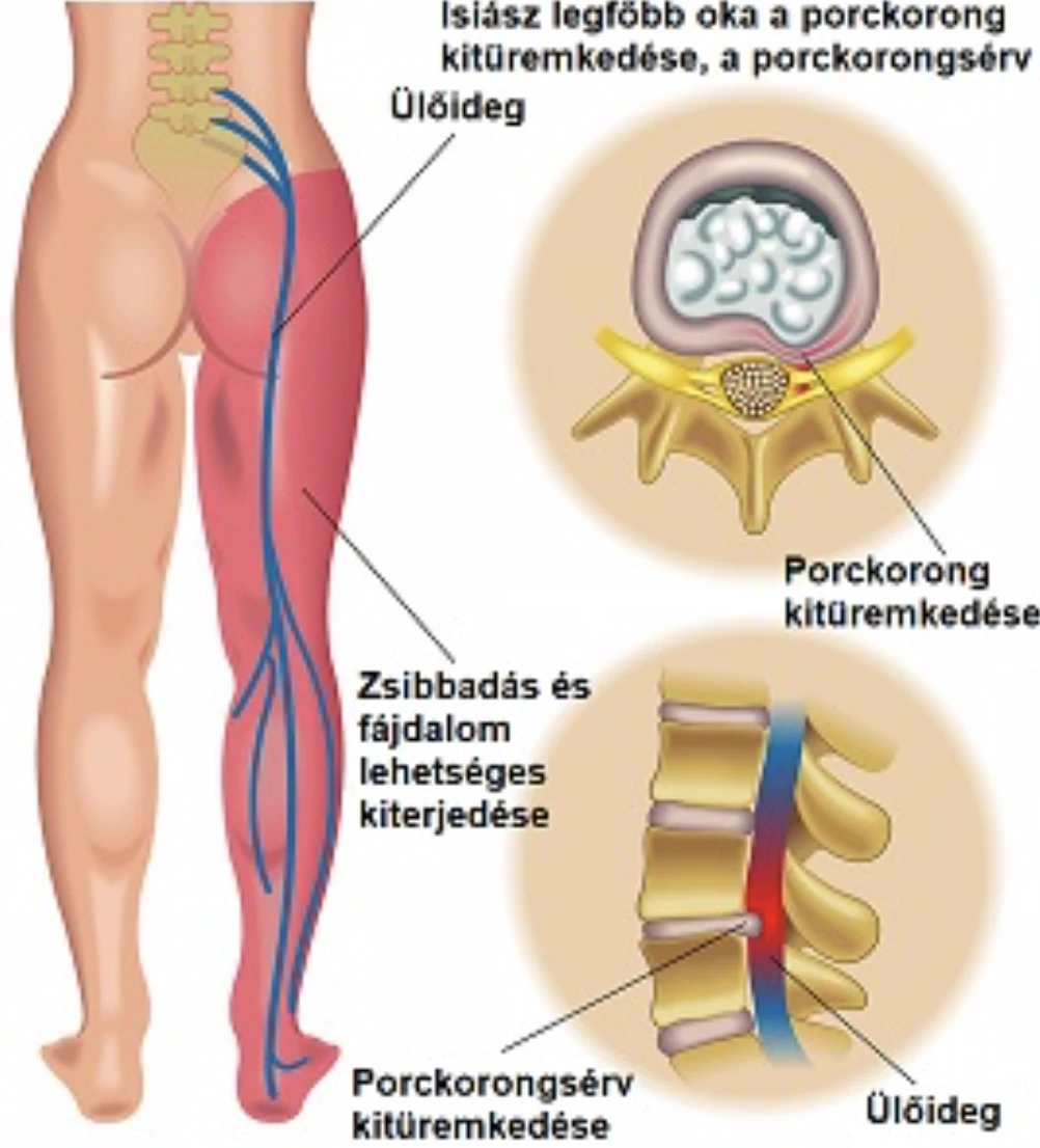 gerncsérv porckorong