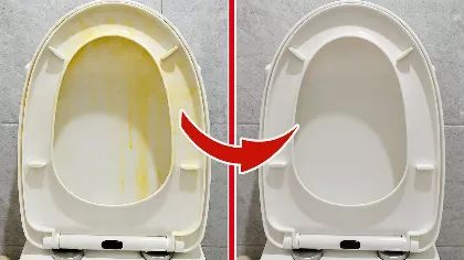 A szállodai takarítók trükkje: így tűnnek el a sárga foltok a WC-ülőkéről