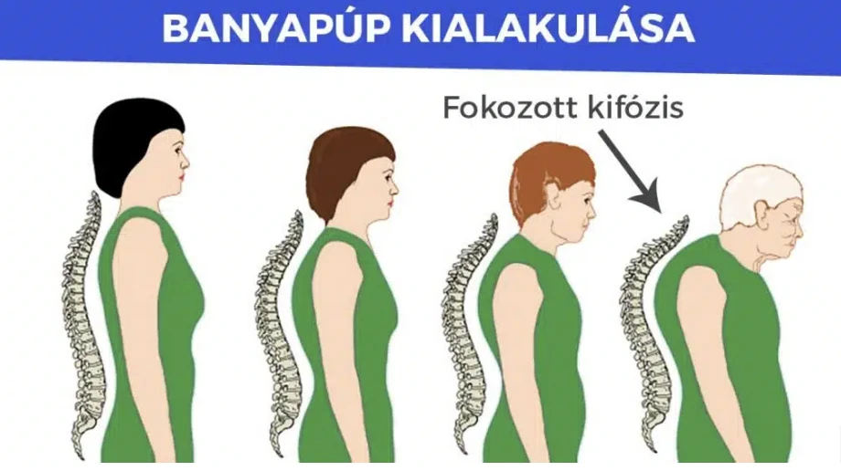 banyapúp kialakulása