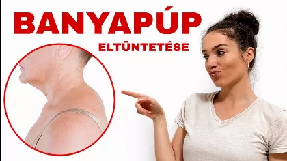 A banyapúp titka: ezért jelenik meg a nyak tövén a makacs dudor