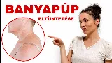 A banyapúp titka: ezért jelenik meg a nyak tövén a makacs dudor
