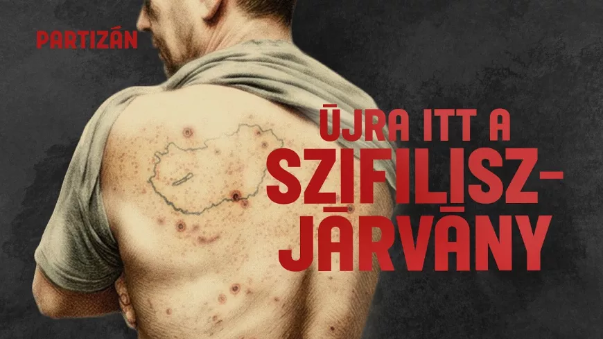 Visszatért a szifilisz: a magyar csecsemőket is érinti