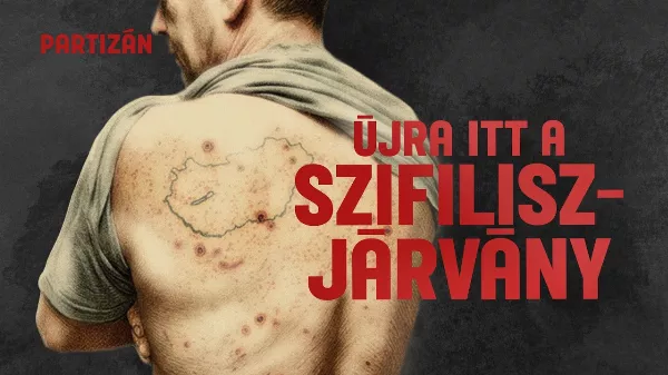Visszatért a szifilisz: a magyar csecsemőket is érinti